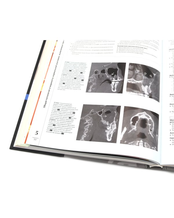 Иллюстрированная анатомия головы и шеи. Профессиональная визуализация в дентальной имплантации. (комплкт из 2-х книг)