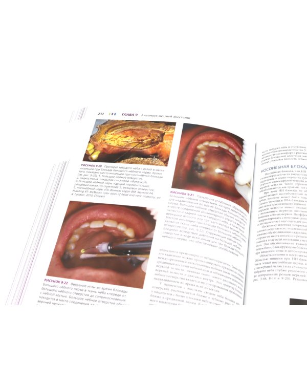 Иллюстрированная анатомия головы и шеи. Профессиональная визуализация в дентальной имплантации. (комплкт из 2-х книг)