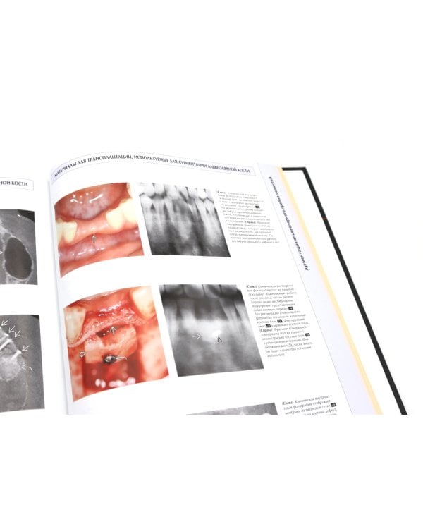 Иллюстрированная анатомия головы и шеи. Профессиональная визуализация в дентальной имплантации. (комплкт из 2-х книг)