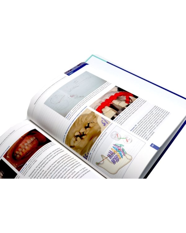 Высота окклюзии в протезировании и ортогнатологии; Клиническое руководство по цифровой стоматологии (комплект из 2-х книг)