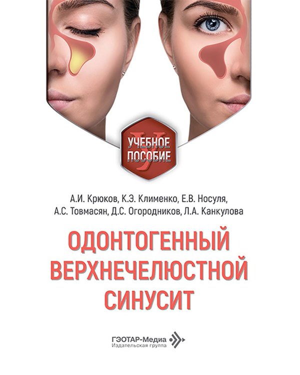 Одонтогенный верхнечелюстной синусит : учебное пособие