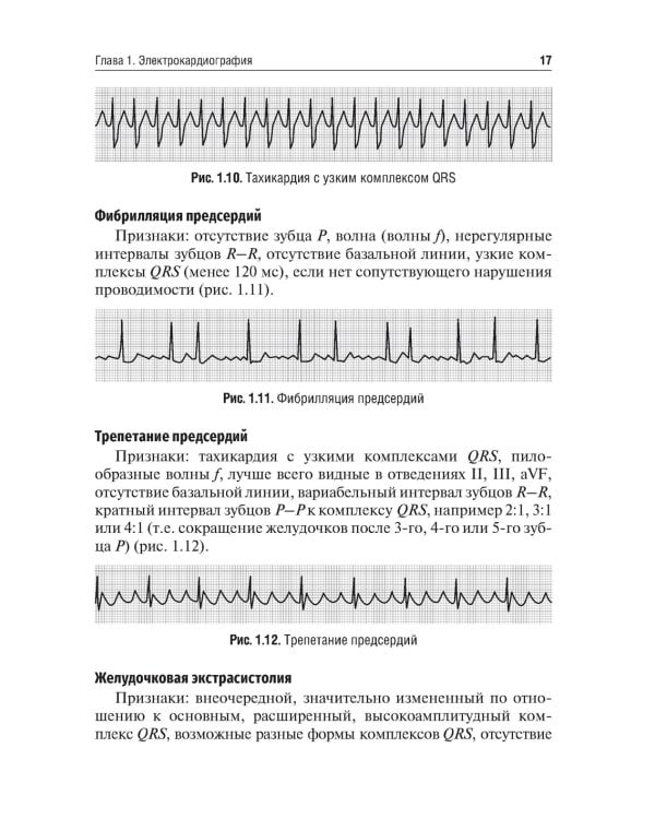 Инструментальная диагностика сердечной патологии: Учебное пособие