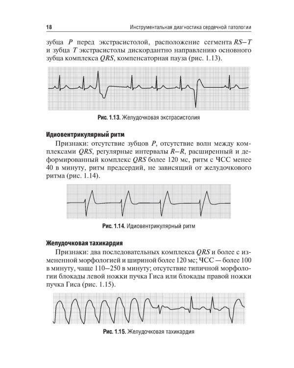Инструментальная диагностика сердечной патологии: Учебное пособие