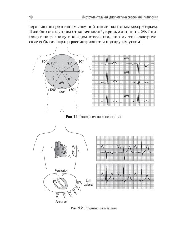 Инструментальная диагностика сердечной патологии: Учебное пособие