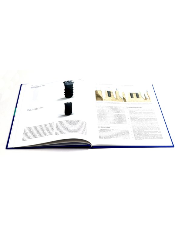 Профессиональная гигиена в области имплантатов и лечение периимплантитов. Несостоятельность дентальной имплантации (комплект из 2-х книг)