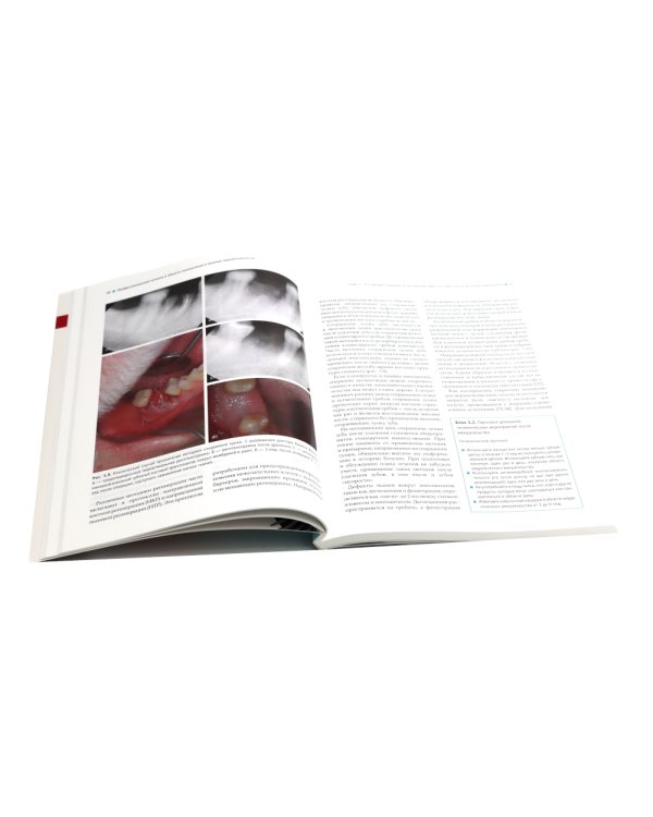 Профессиональная гигиена в области имплантатов и лечение периимплантитов. Несостоятельность дентальной имплантации (комплект из 2-х книг)