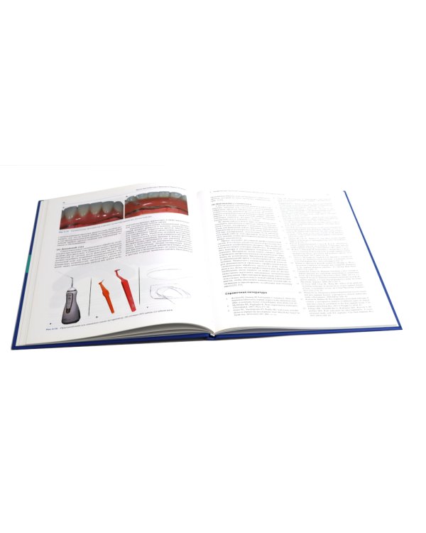 Профессиональная гигиена в области имплантатов и лечение периимплантитов. Несостоятельность дентальной имплантации (комплект из 2-х книг)