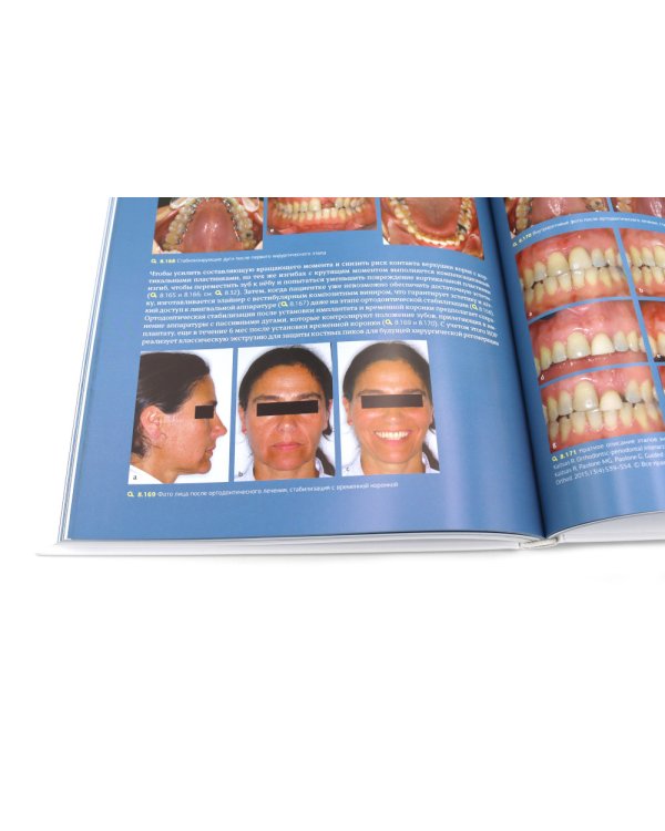 Ортодонтия и пародонтология; Мукогингивальная хирургия вокруг зубов и имплантатов (комплект из 2-х книг)