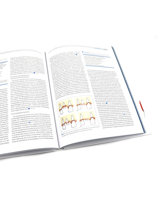 Ортодонтия и пародонтология; Мукогингивальная хирургия вокруг зубов и имплантатов (комплект из 2-х книг)