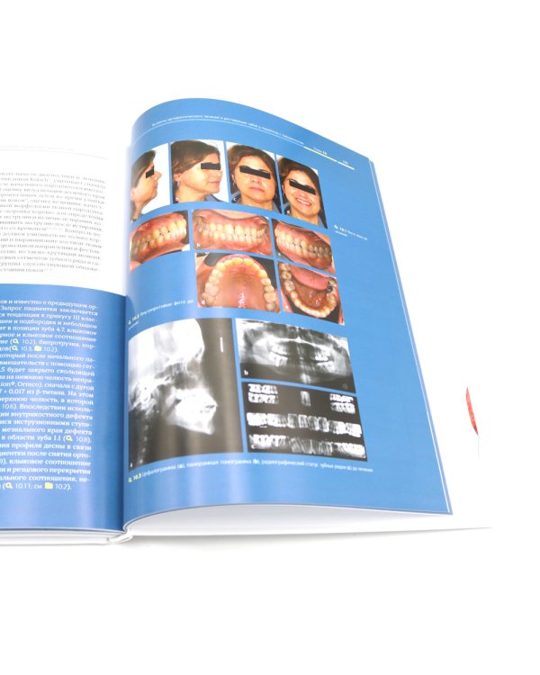 Ортодонтия и пародонтология; Мукогингивальная хирургия вокруг зубов и имплантатов (комплект из 2-х книг)