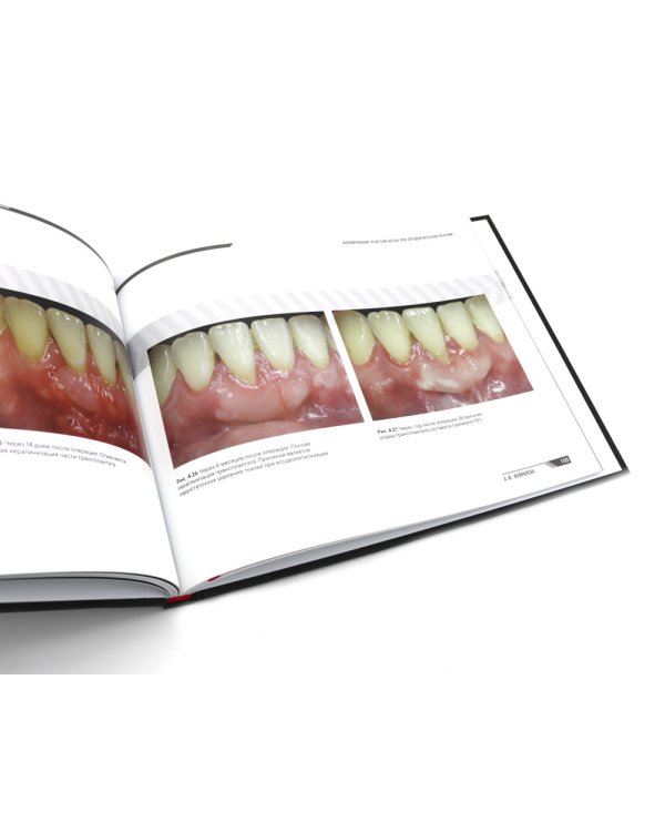 Ортодонтия и пародонтология; Мукогингивальная хирургия вокруг зубов и имплантатов (комплект из 2-х книг)