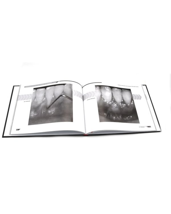 Ортодонтия и пародонтология; Мукогингивальная хирургия вокруг зубов и имплантатов (комплект из 2-х книг)