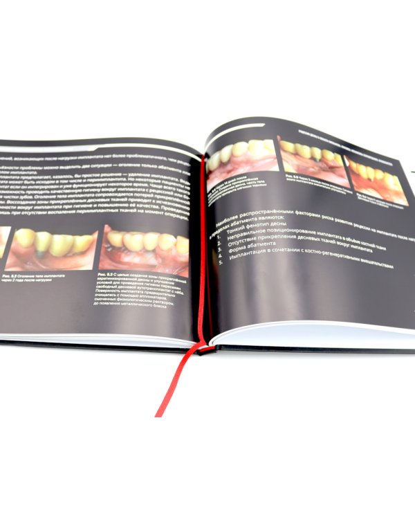 Ортодонтия и пародонтология; Мукогингивальная хирургия вокруг зубов и имплантатов (комплект из 2-х книг)