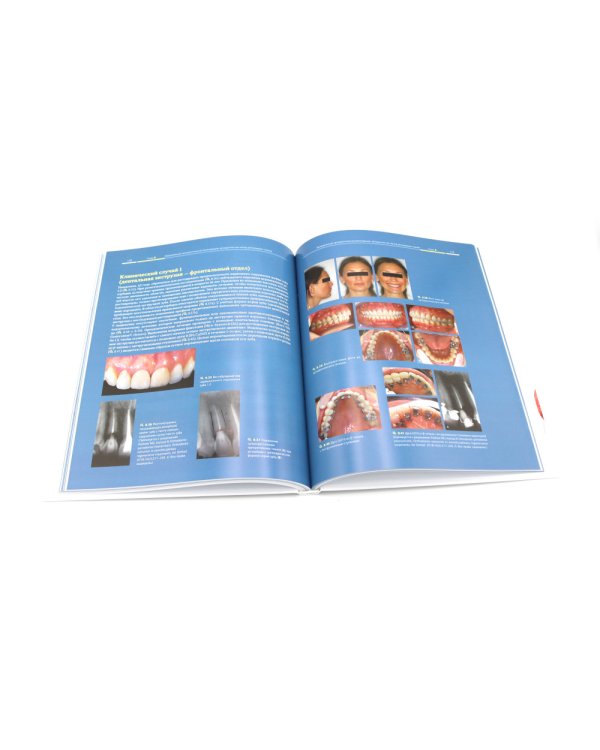 Ортодонтия и пародонтология; Мукогингивальная хирургия вокруг зубов и имплантатов (комплект из 2-х книг)