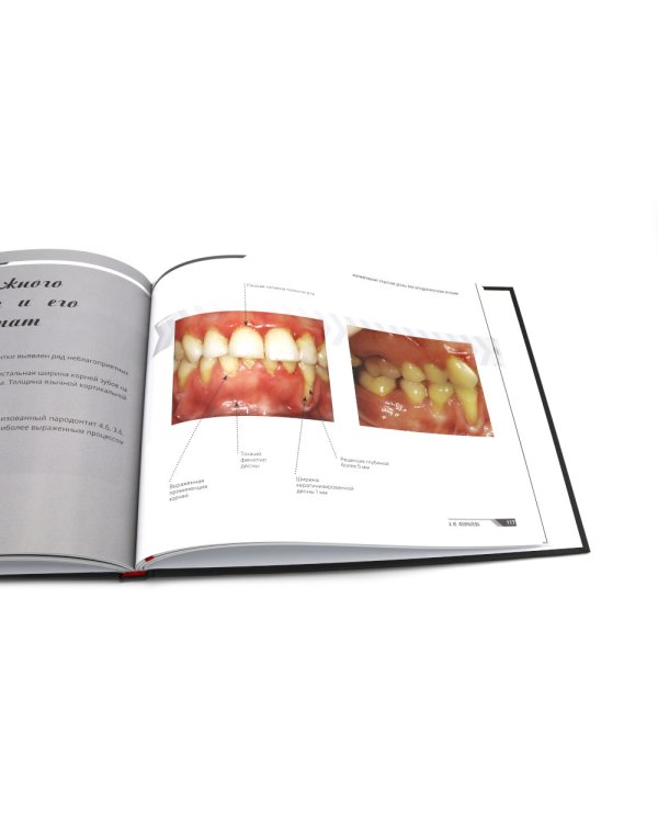 Ортодонтия и пародонтология; Мукогингивальная хирургия вокруг зубов и имплантатов (комплект из 2-х книг)