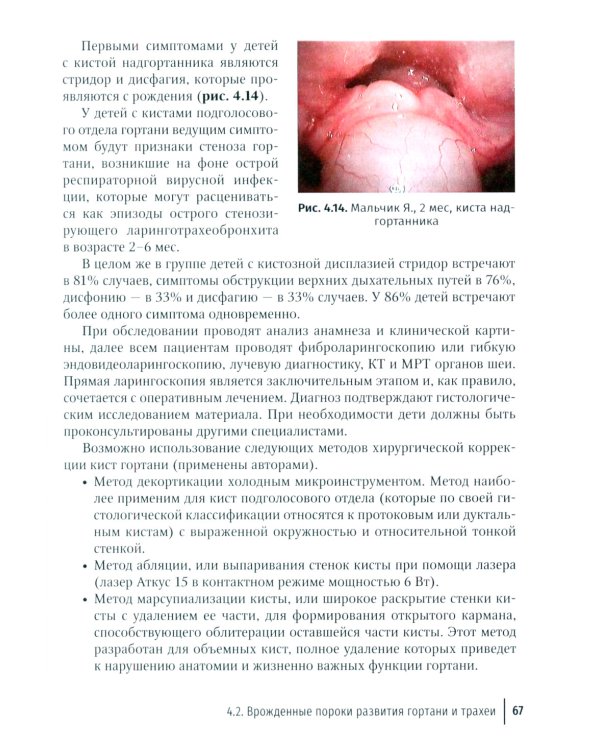 Дисфагия у детей