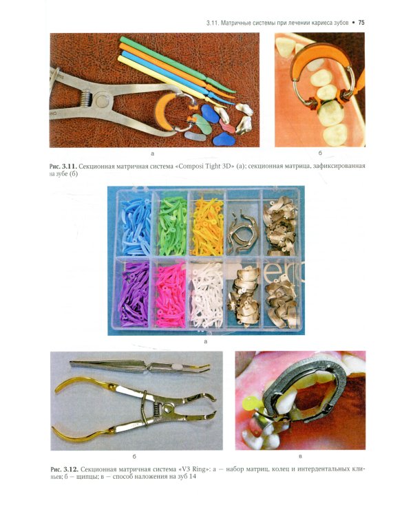 Терапевтическая стоматология: Учебник. В 3 ч. Ч. 1: Болезни зубов. 2-е изд., перераб