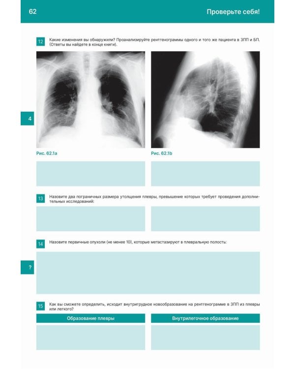 Рентгенологическое исследование грудной клетки. Практическое руководство. Атлас. 2-е изд., перераб.и доп