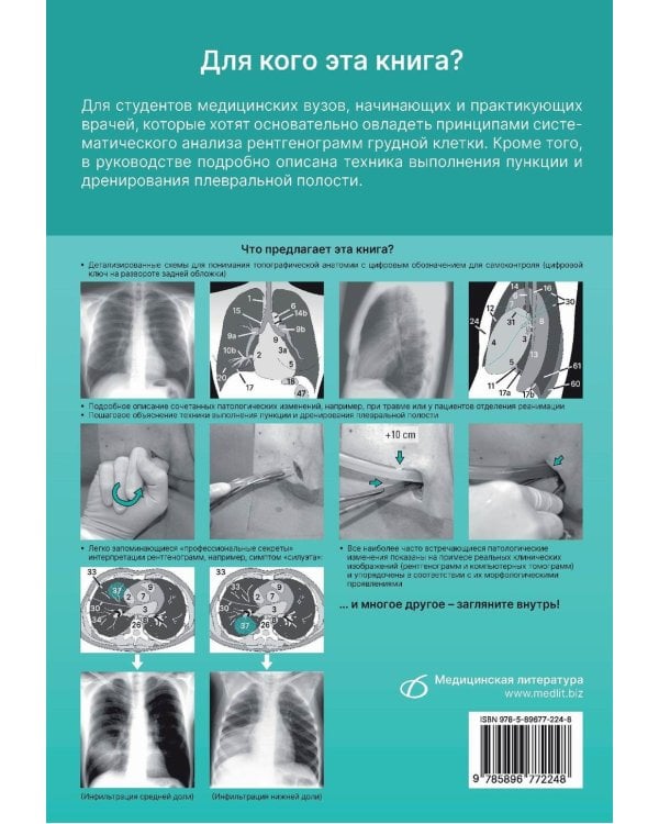 Рентгенологическое исследование грудной клетки. Практическое руководство. Атлас. 2-е изд., перераб.и доп