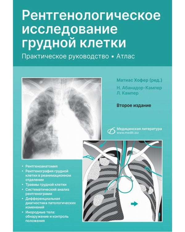 Рентгенологическое исследование грудной клетки. Практическое руководство. Атлас. 2-е изд., перераб.и доп