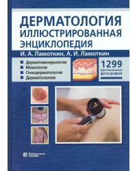 Дерматология. Иллюстрированная энциклопедия. Дерматовенерология. Микология. Онкодерматология. Дерматоскопия