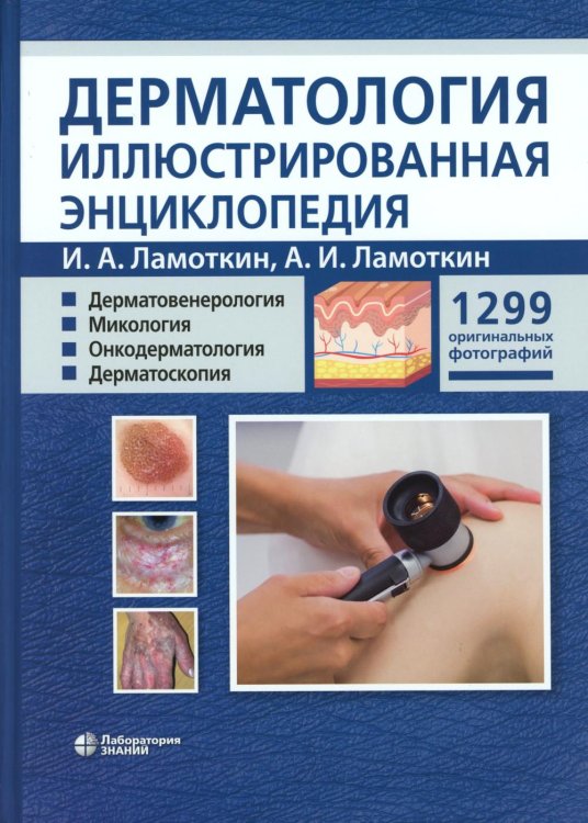 Дерматология. Иллюстрированная энциклопедия. Дерматовенерология. Микология. Онкодерматология. Дерматоскопия
