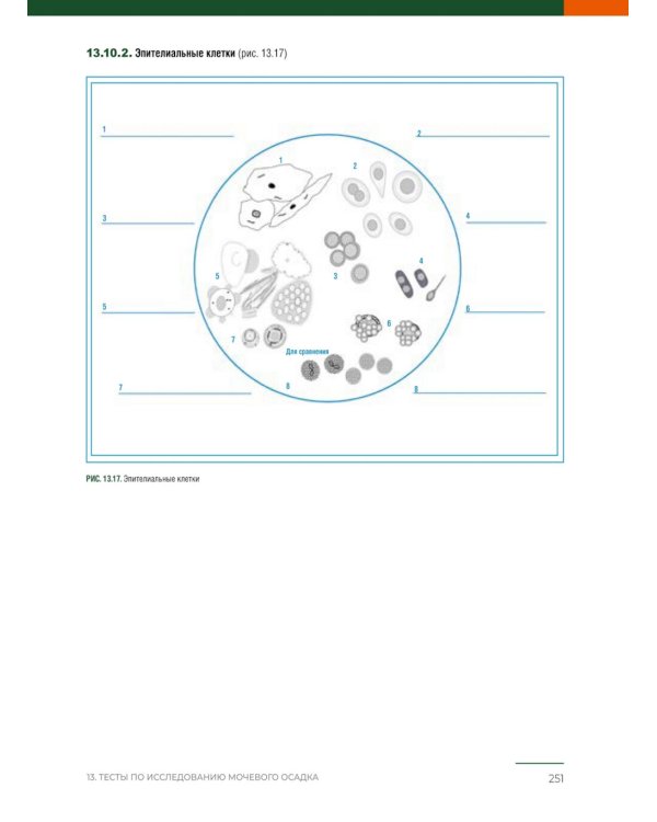 Анализ осадка мочи