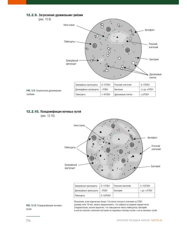 Анализ осадка мочи