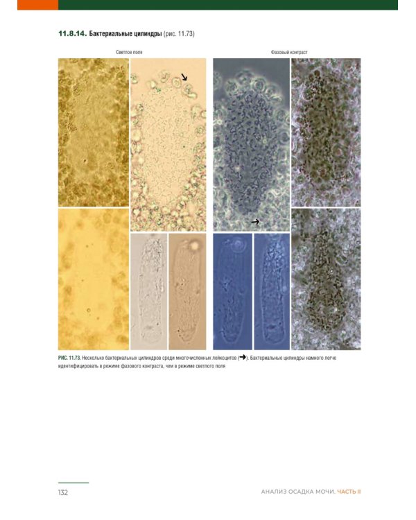 Анализ осадка мочи