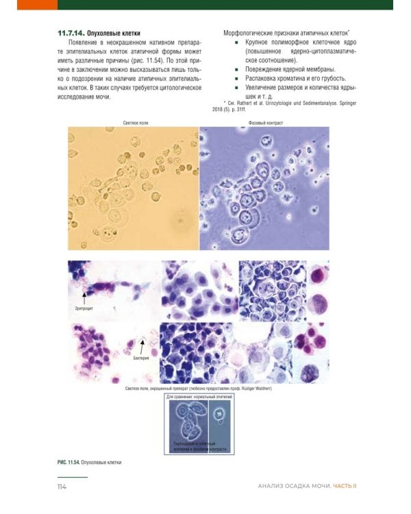 Анализ осадка мочи