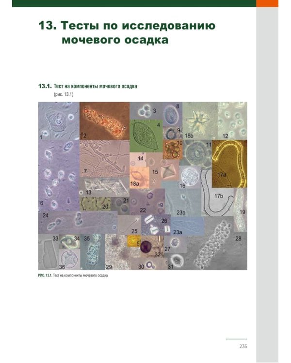 Анализ осадка мочи