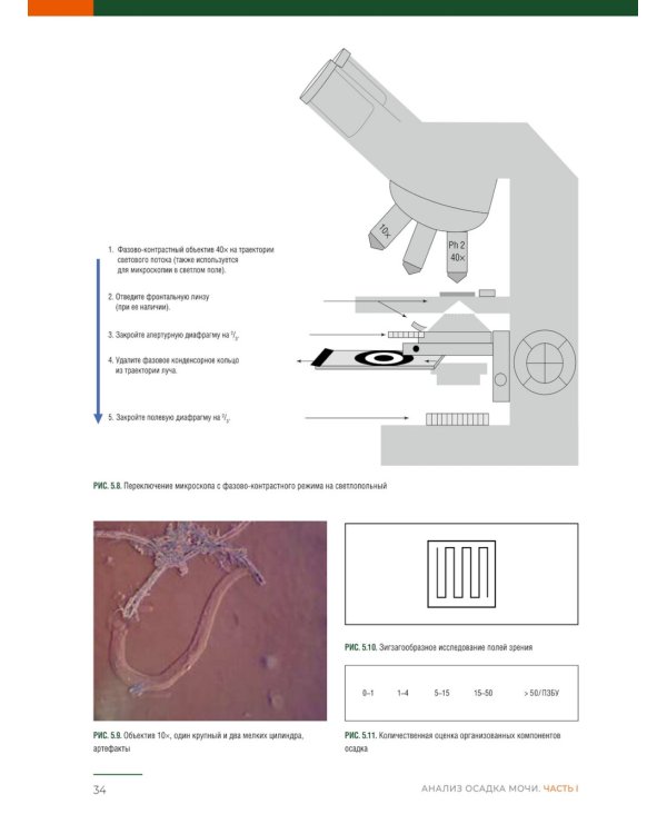 Анализ осадка мочи