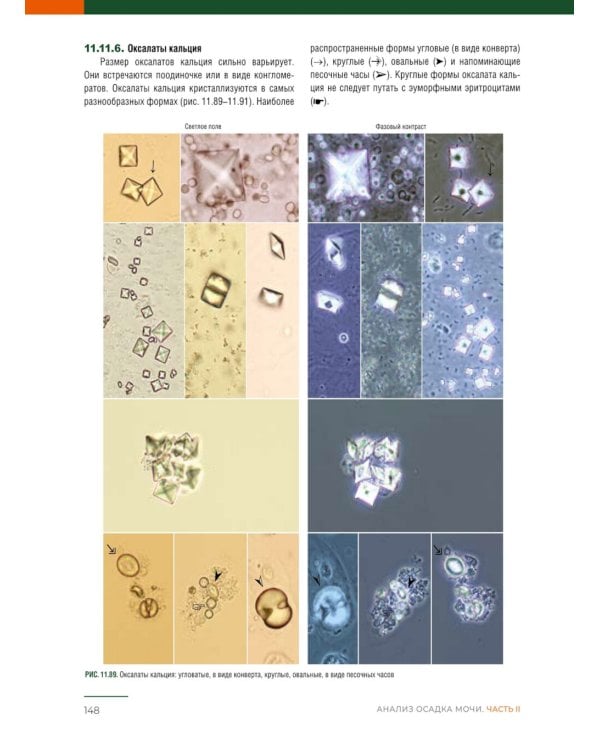 Анализ осадка мочи