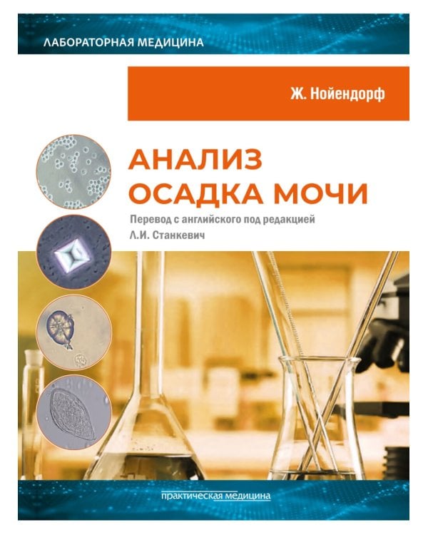 Анализ осадка мочи