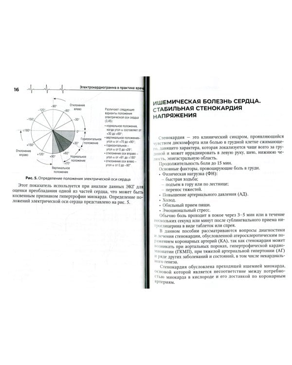 Электрокардиограмма в практике врача: руководство