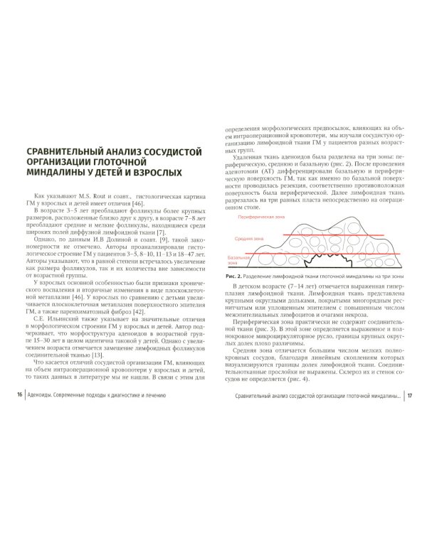 Аденоиды. Современные подходы к диагностике и лечению: руководство для врачей