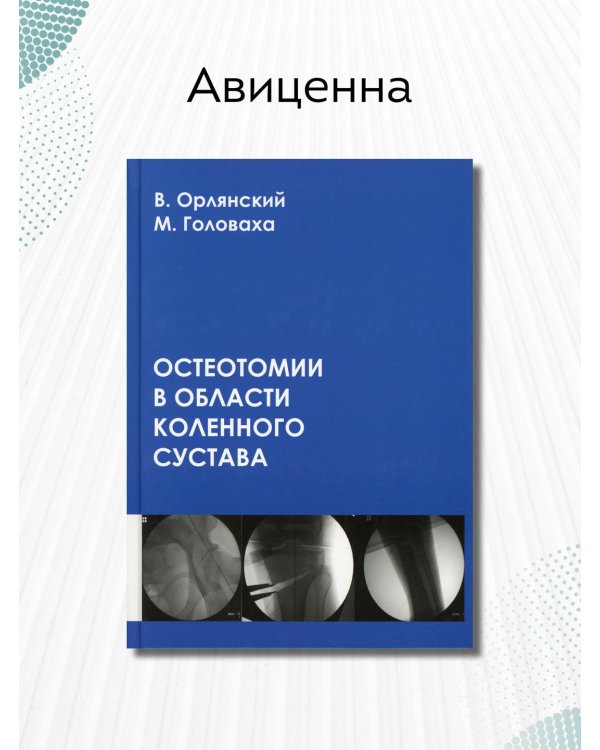 Остеотомии в области коленного сустава