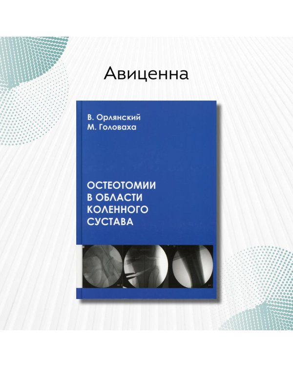 Остеотомии в области коленного сустава