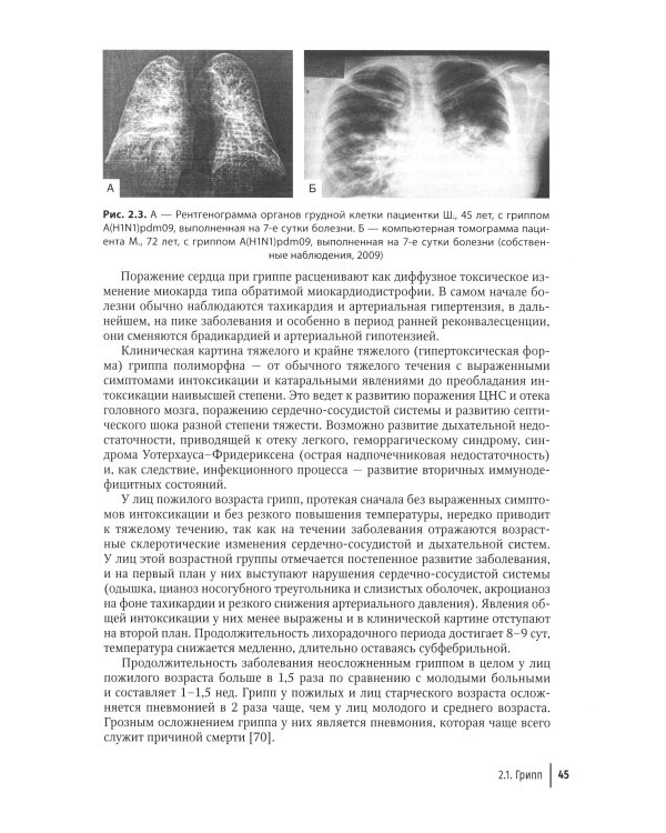 Грипп и ОРВИ в XXI веке: руководство для врачей