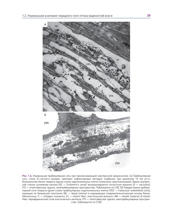 Новые концепции в хирургии глаукомы