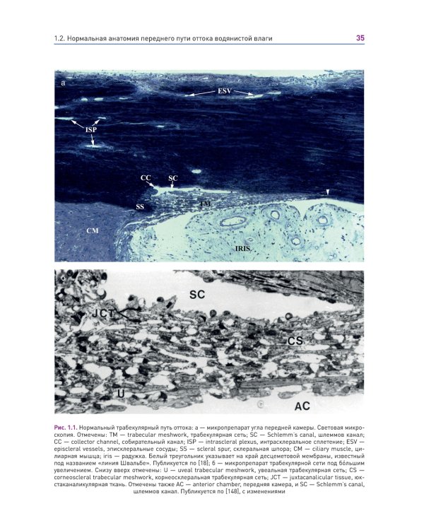 Новые концепции в хирургии глаукомы