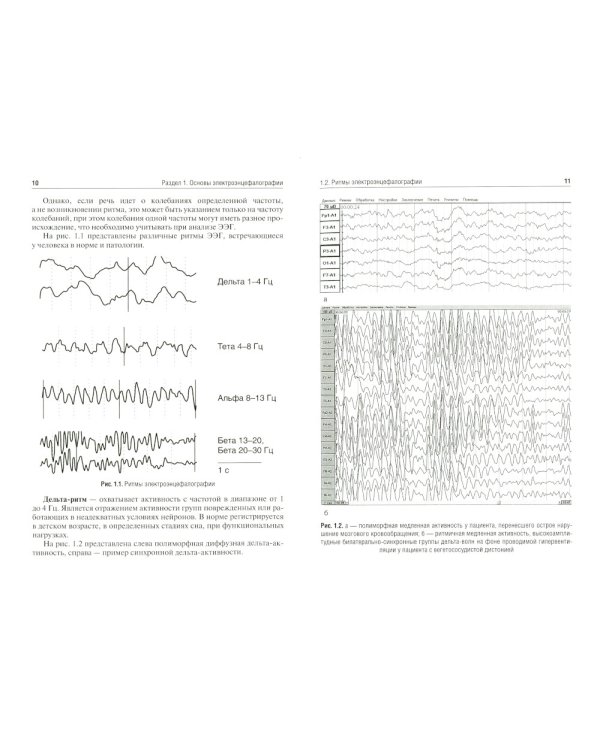 Методы функциональной диагностики в неврологии: Учебное пособие