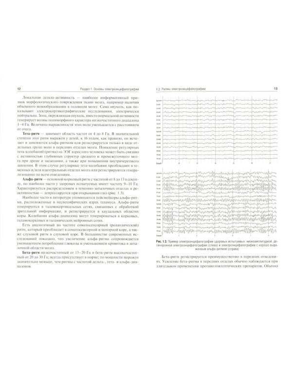 Методы функциональной диагностики в неврологии: Учебное пособие