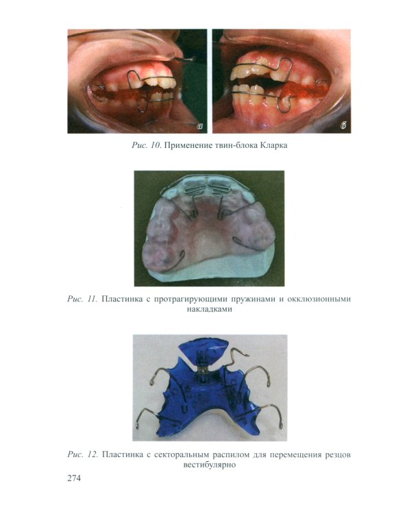 Основы ортодонтии: Учебное пособие. 3-е изд., испр.и доп
