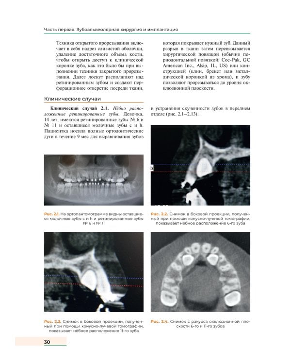 Оперативная хирургия полости рта и челюстно-лицевой области. Атлас