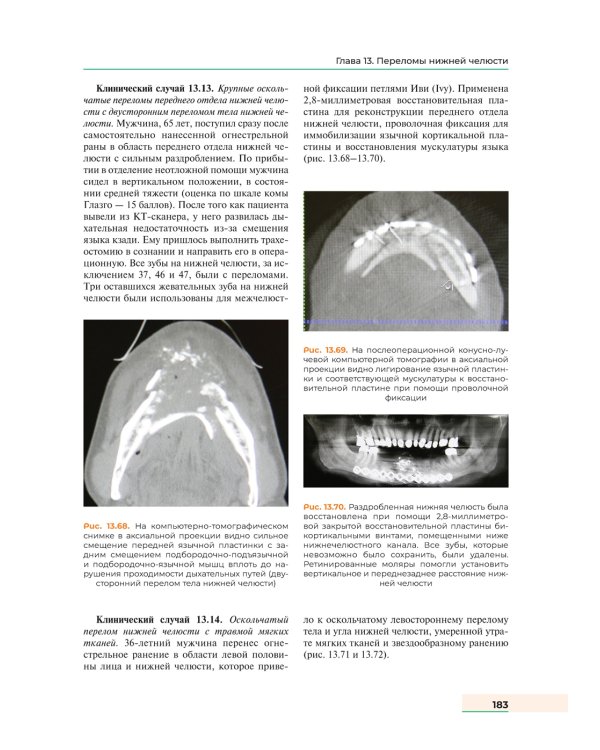 Оперативная хирургия полости рта и челюстно-лицевой области. Атлас