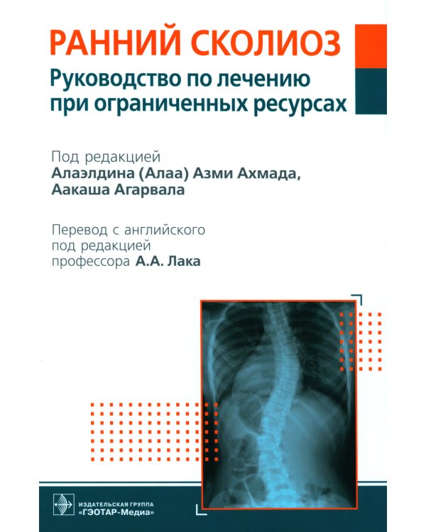 Ранний сколиоз. Руководство по лечению при ограниченных ресурсах