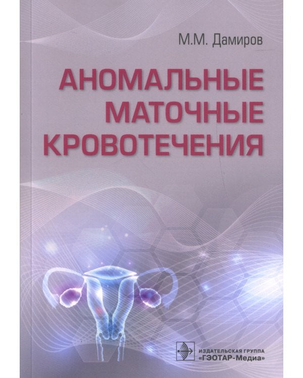 Аномальные маточные кровотечения