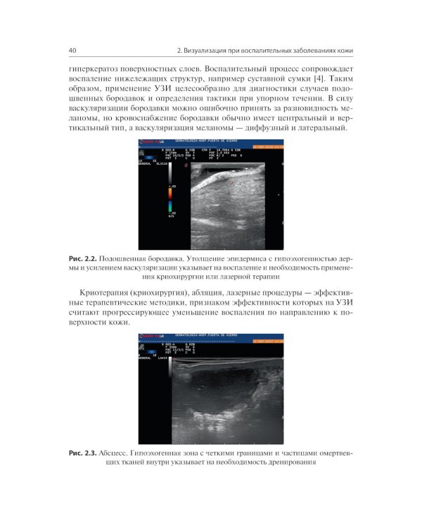 Визуализация в дерматологии