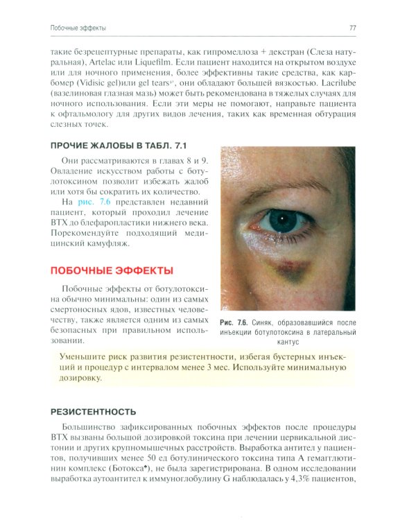 Применение ботулотоксина в процедурах по омоложению лица